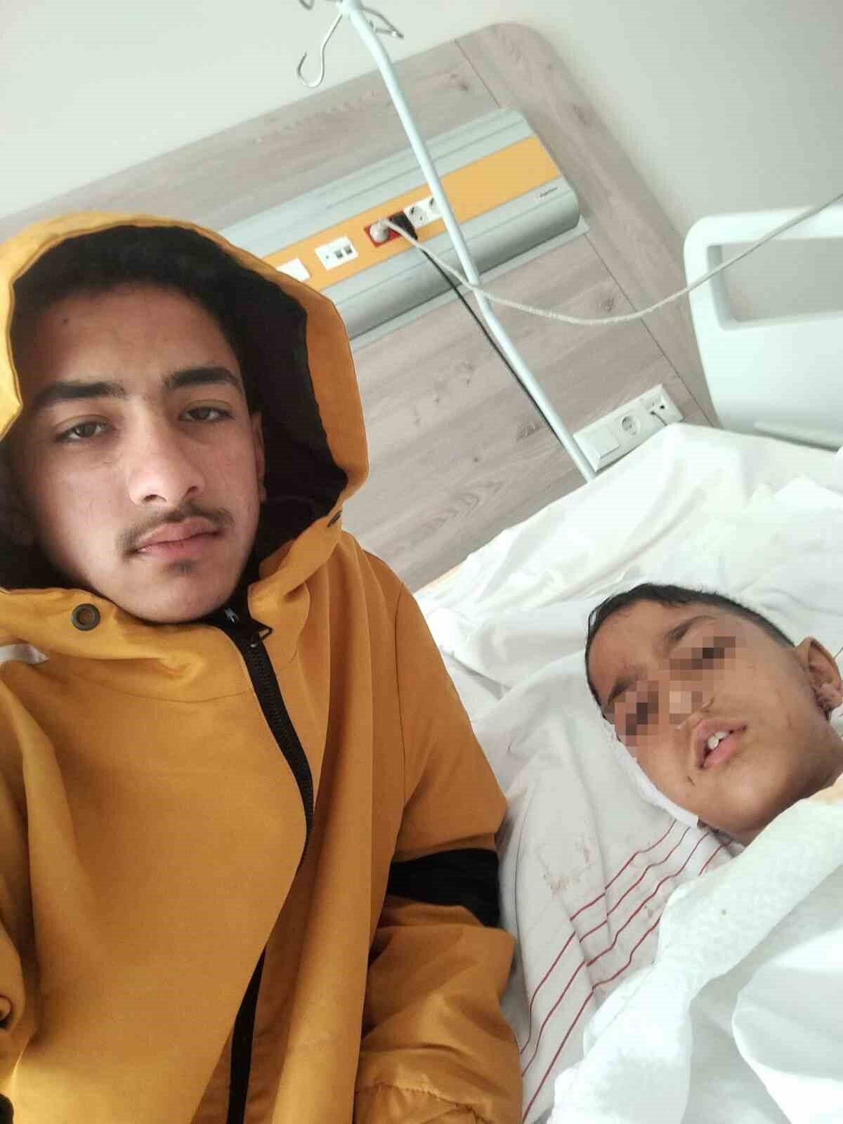 Ankara’nın Altındağ ilçesinde okuldan evine dönen bir çocuk, başıboş köpeğin