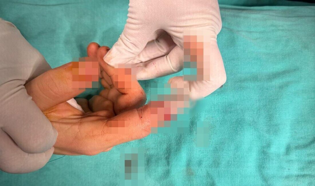 Balıkesir’in Bandırma ilçesinde yaşanan asansör kazasında parmağı kopan bir vatandaş,