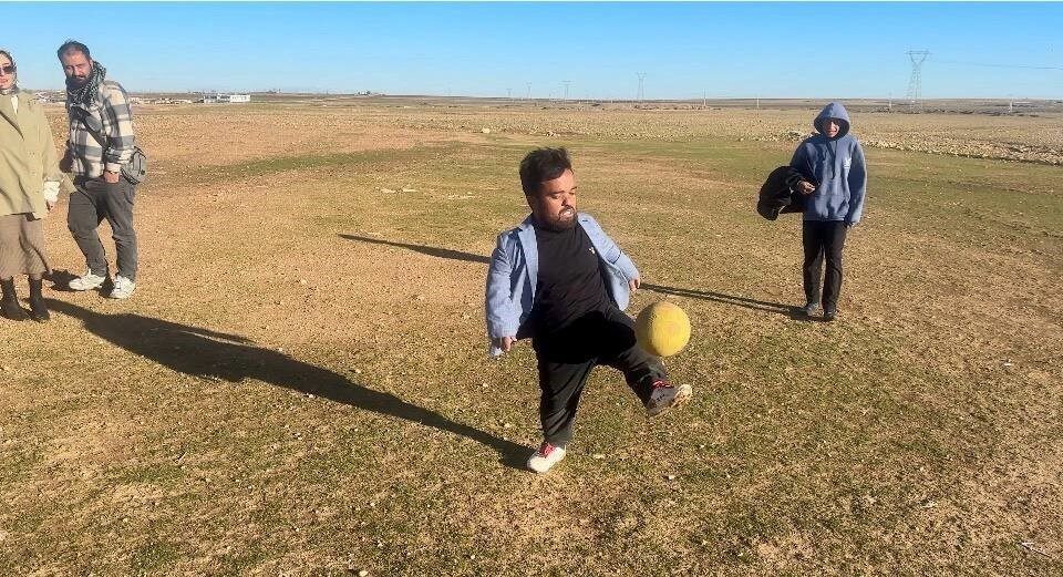 Şanlıurfa’da halk arasında cücelik olarak adlandırılan akondroplazi rahatsızlığı nedeniyle boyu