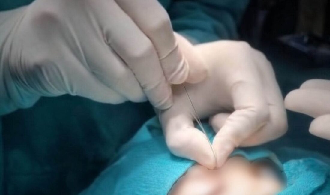 Hakkari’nin Çukurca Devlet Hastanesi’nde göz hastalıkları alanında ileri düzey tedavi