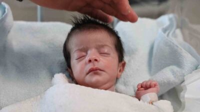Doğuştan yemek borusu olmayan Ada bebek, doğumunun 4’üncü gününde Fethi