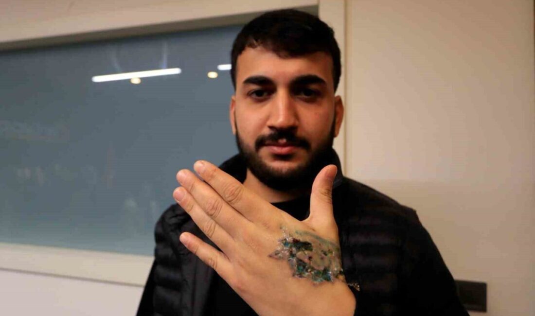 Bir güzellik merkezinde elindeki dövmeyi sildirmek isteyen Yasin Taş’ın sol