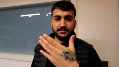 Bir güzellik merkezinde elindeki dövmeyi sildirmek isteyen Yasin Taş’ın sol