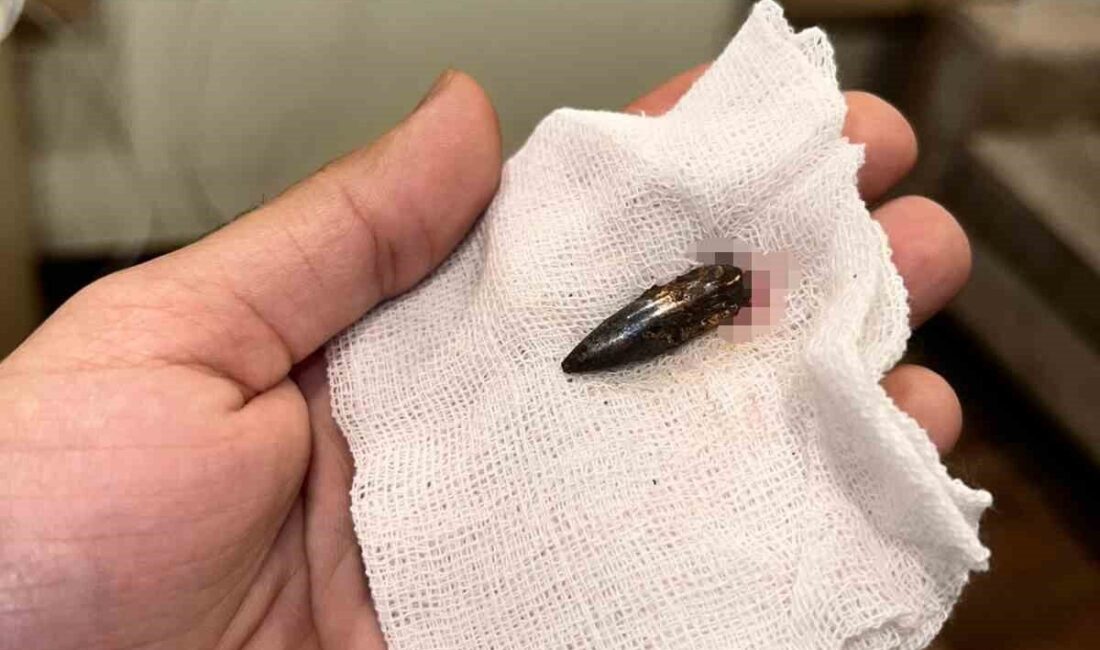 İsrail ordusunun Gazze Şeridi’ne yönelik saldırılarında başından vurulan küçük Awad,