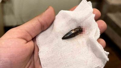 İsrail ordusunun Gazze Şeridi’ne yönelik saldırılarında başından vurulan küçük Awad,