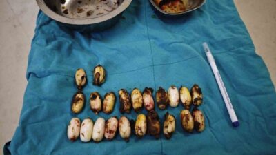 Eskişehir’e 44 kapsül uyuşturucu maddeyi midesinde sokmaya çalışan yabancı uyruklu