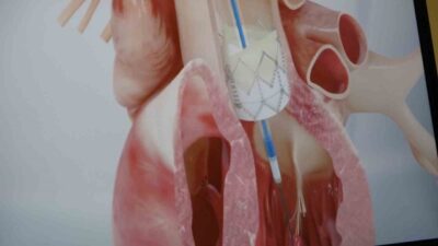 İnönü Üniversitesi Tıp Fakültesi Kardiyoloji Ana Bilim Dalı Öğretim Üyesi