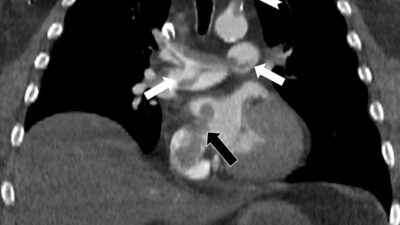 Özel Denizli Tekden Hastanesi’nde görev yaptığı dönemde de başarılı çalışmalara