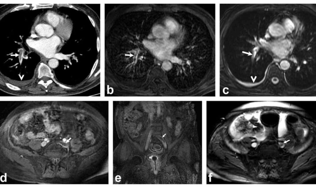 DENİZLİ (İHA) – Özel Denizli Tekden Hastanesinde bir dönem başarılı