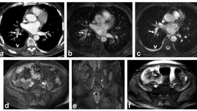 DENİZLİ (İHA) – Özel Denizli Tekden Hastanesinde bir dönem başarılı