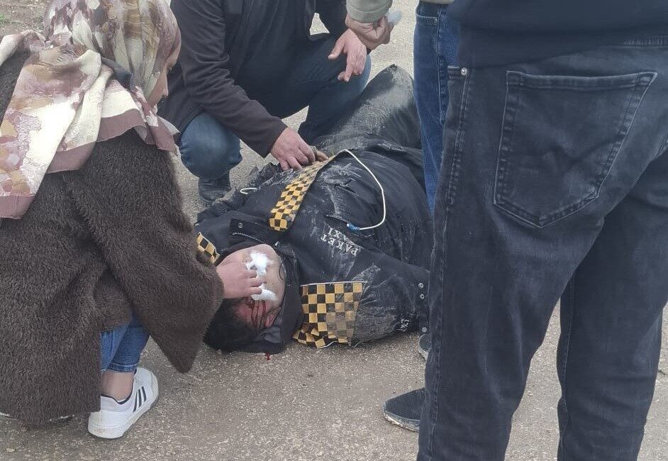 Adıyaman’da motosikletin devrilmesi sonucu meydana gelen kazada 1 kişi yaralandı.