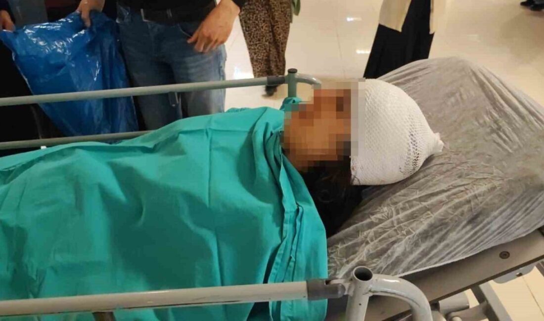 Adana’da ekmek almaya giderken sokak köpeklerinin saldırısına uğrayan genç kız