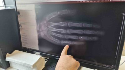 Eskişehir Şehir Hastanesi Çocuk Hematoloji ve Onkoloji alanında görevli Doç.