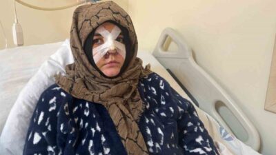 Gaziantep’te boşanmak istediği kocasının öldüresiye darp ettiği Nazlı Yavuz, yaşadığı