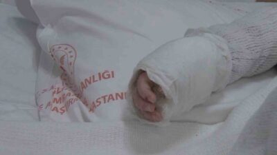 İstanbul’da kaynar suyun üzerine devrilmesi sonucu 20 aylık bebeğin vücudunun