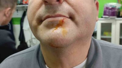 Zonguldak’ın Karadeniz Ereğli ilçesinde oynanan 3. lig maçının ardından çıkan