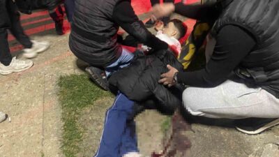 Bursa’nın Mudanya ilçesinde bir parkta çıkan bıçaklı kavgada 16 yaşındaki