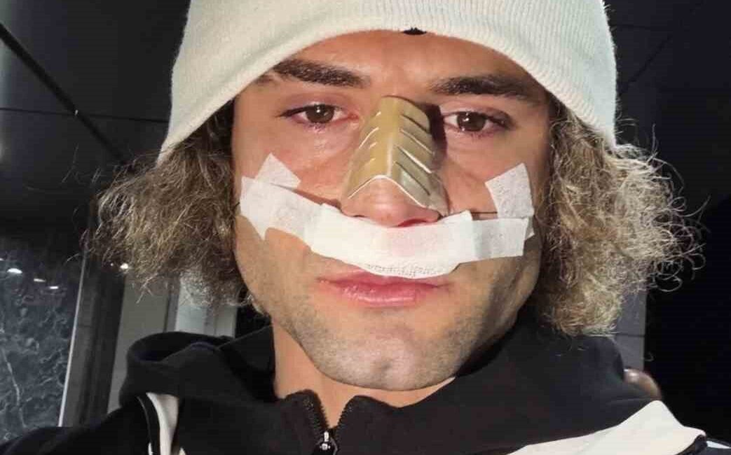 Elazığspor’un yıldızı Fuat Bavuk’un Muğlaspor maçında burnu kırıldı. Nesine 2.