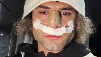 Elazığspor’un yıldızı Fuat Bavuk’un Muğlaspor maçında burnu kırıldı. Nesine 2.