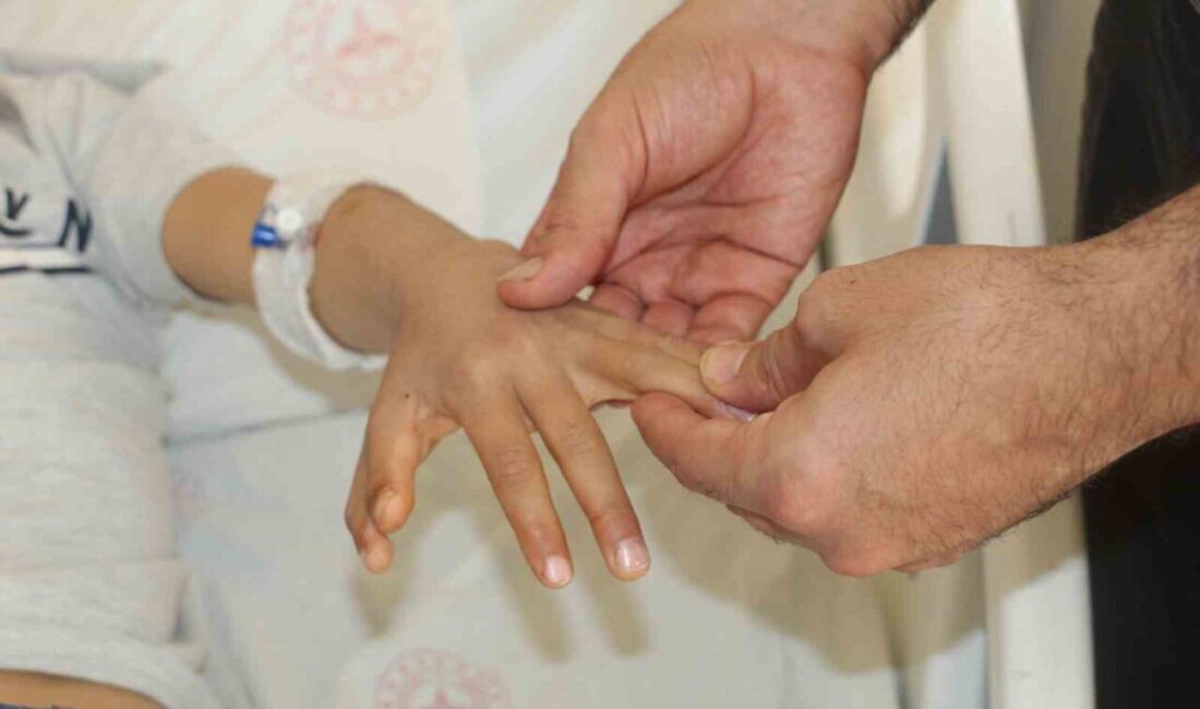 Şırnak’ta doğuştan yapışık parmak (sindaktili) hastalığı bulunan iki kardeş, gerçekleştirilen