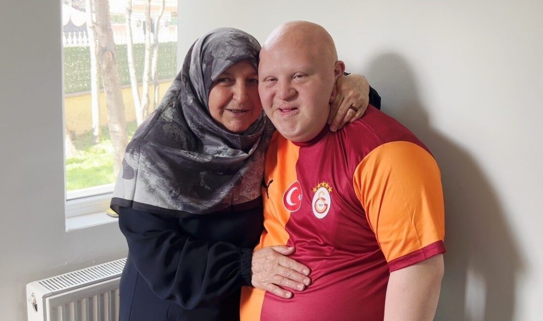 Erzurum’da yaşayan 52 yaşındaki Nuran Sağlam, 20 yaşındaki Down sendromlu