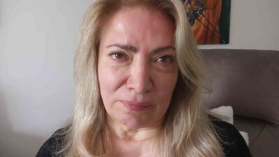 Ankara’da yüzündeki kırışıklıklar nedeniyle internetten bulduğu bir güzellik merkezine giden