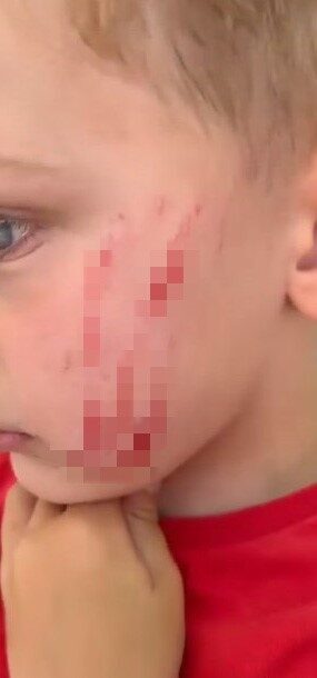 Van’ın Edremit ilçesinde sokakta oyun oynayan 4 yaşındaki çocuk, bir